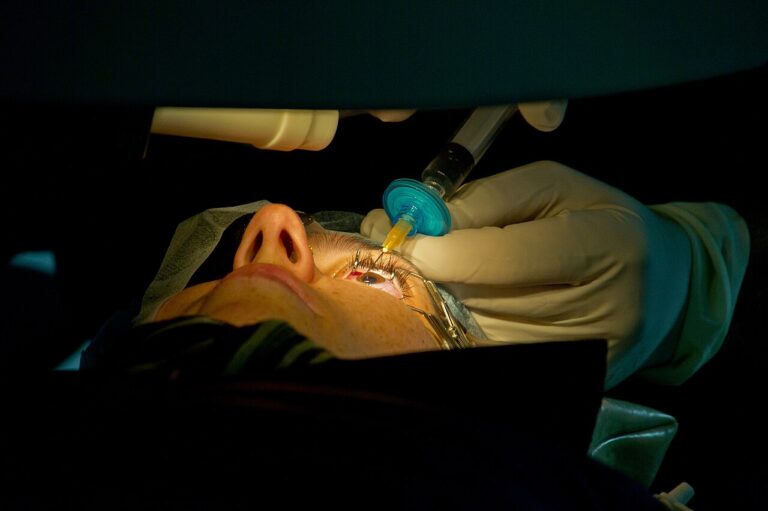 عملية تصحيح النظر بالليزر LASIK داخل غرفة العمليات